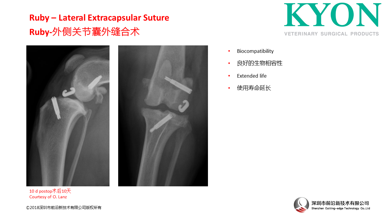 瑞士Kyon Ruby – Lateral Extracapsular Suture 外侧关节囊外缝合术