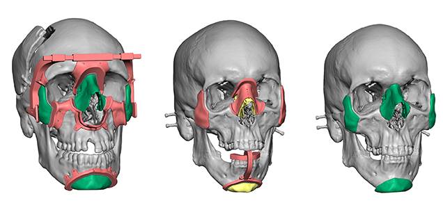 3D打印材料解析大全 3D打印材料解析大全
