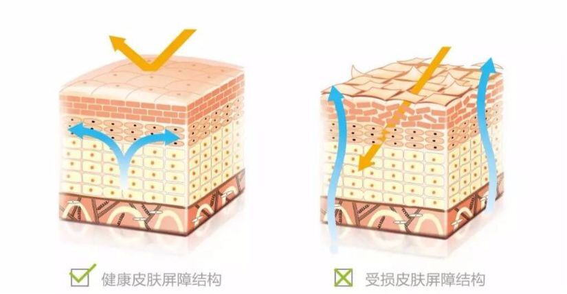[Histomer海皙曼]敷面膜的错误方法，可能导致皮肤过敏