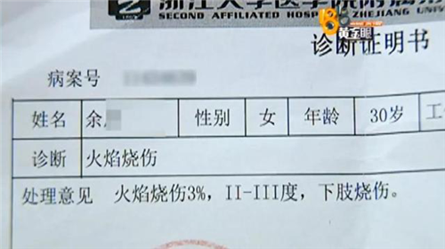 被美容院技师绑住火疗 女模特腿部严重烧伤 被美容院技师绑住火疗 女模特腿部严重烧伤