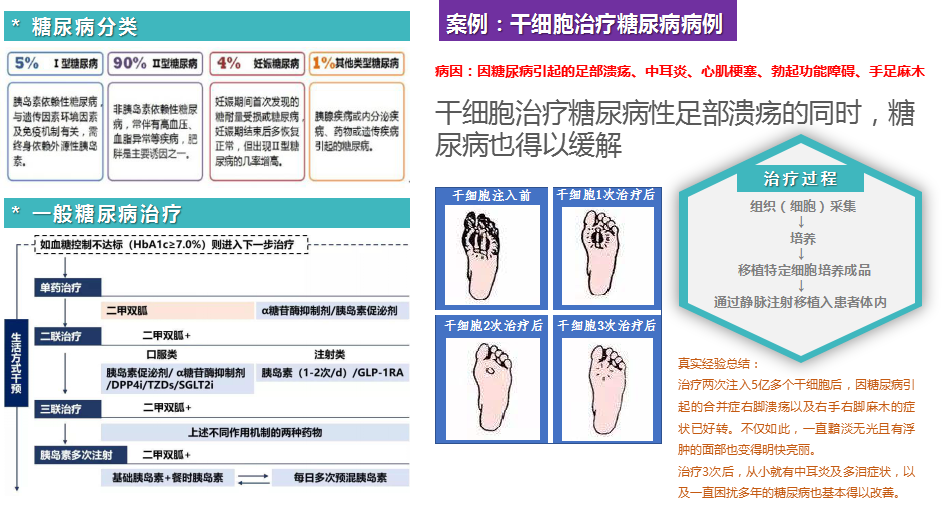 日本干细胞再生诊疗 日本干细胞再生诊疗