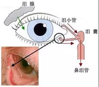 眼睛干澀需注意，別讓你的眼睛再“干渴”