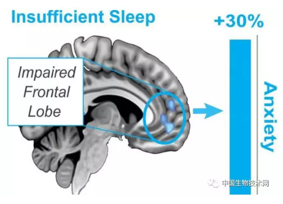 睡眠，焦虑，Nature子刊证实两者间最强大的神经联系