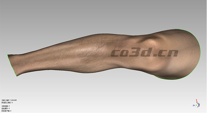 3D scanning of human legs