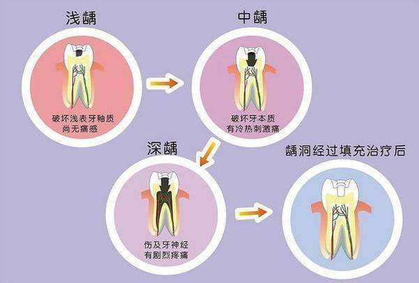 在深圳口腔医院牙齿修复如何既省钱又省心？看这儿！