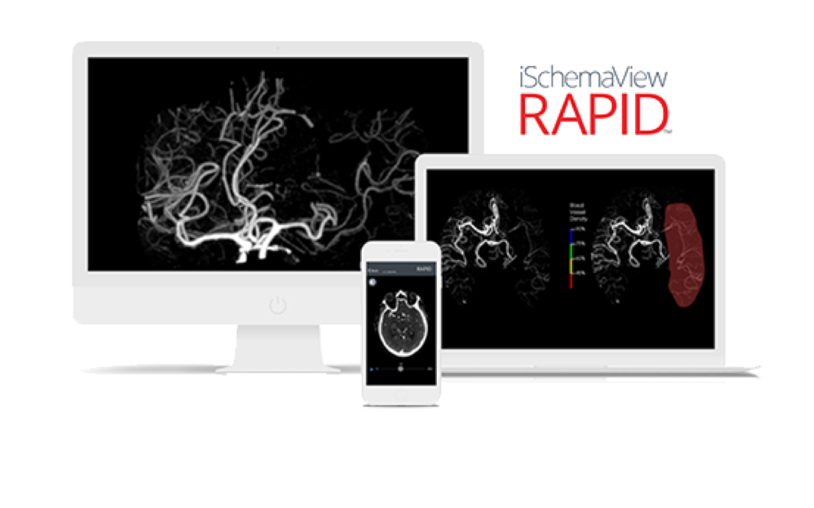 RAPID RAPID