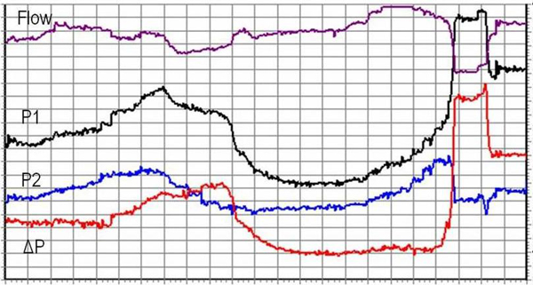 电磁控制阀200系列 电磁控制阀200系列