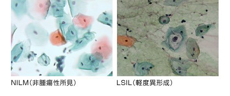 女性检查 限女性 Pet Ct防癌检查 深圳慈惠健康管理有限公司