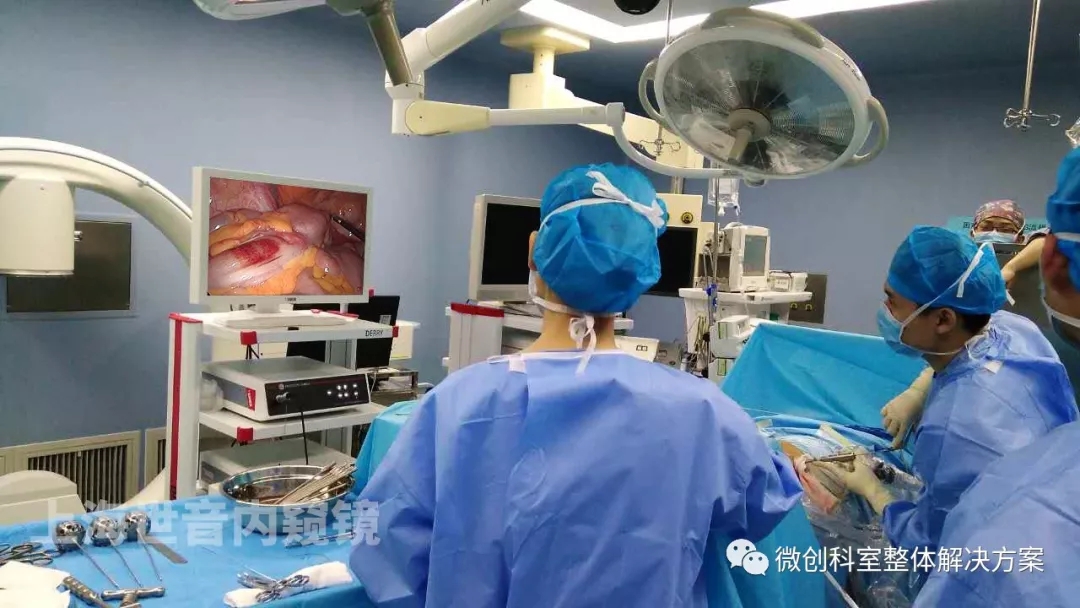 【腹腔镜篇】右半结肠切除术 【腹腔镜篇】右半结肠切除术