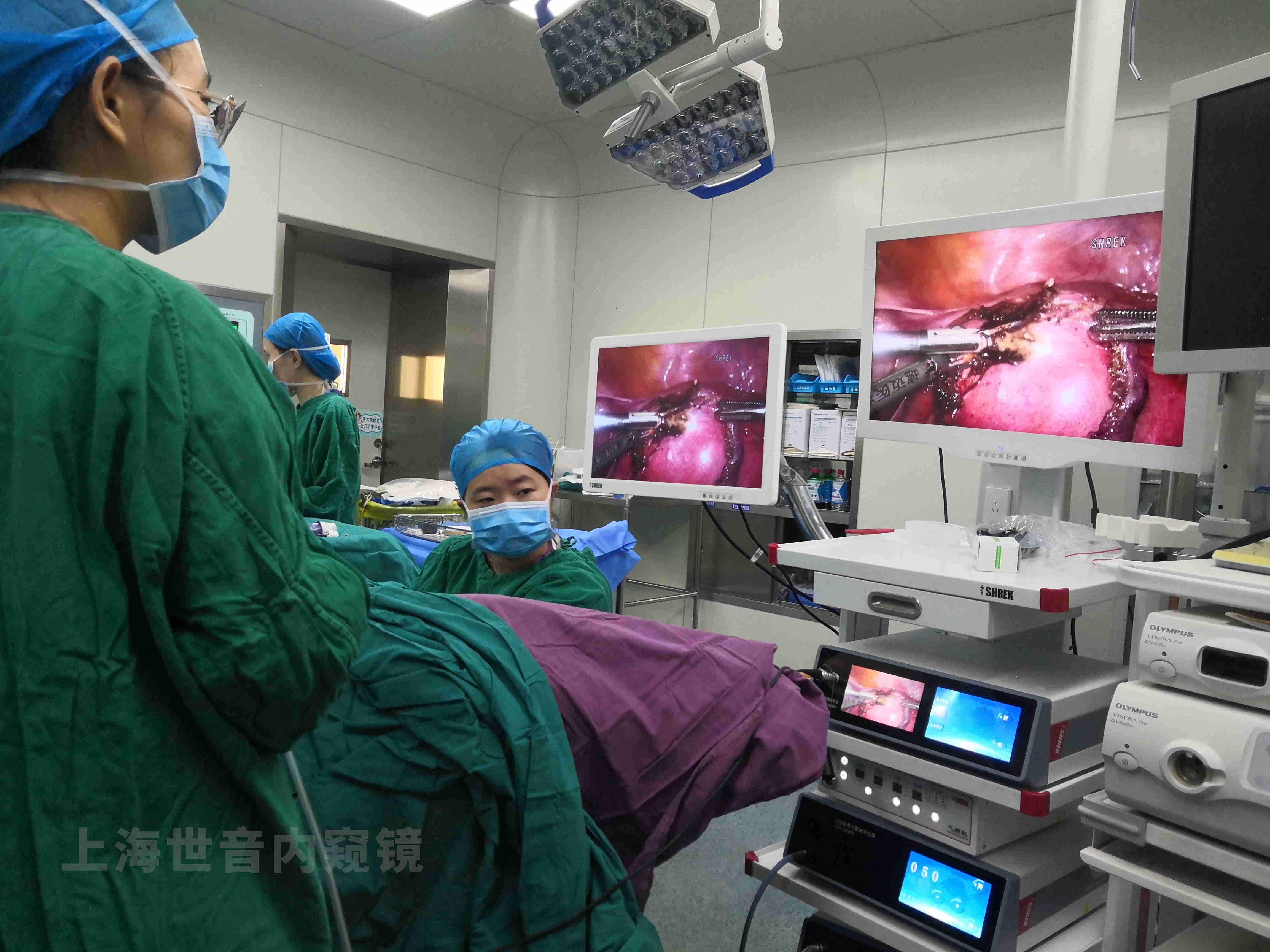 【腹腔镜篇】3D腹腔镜手术