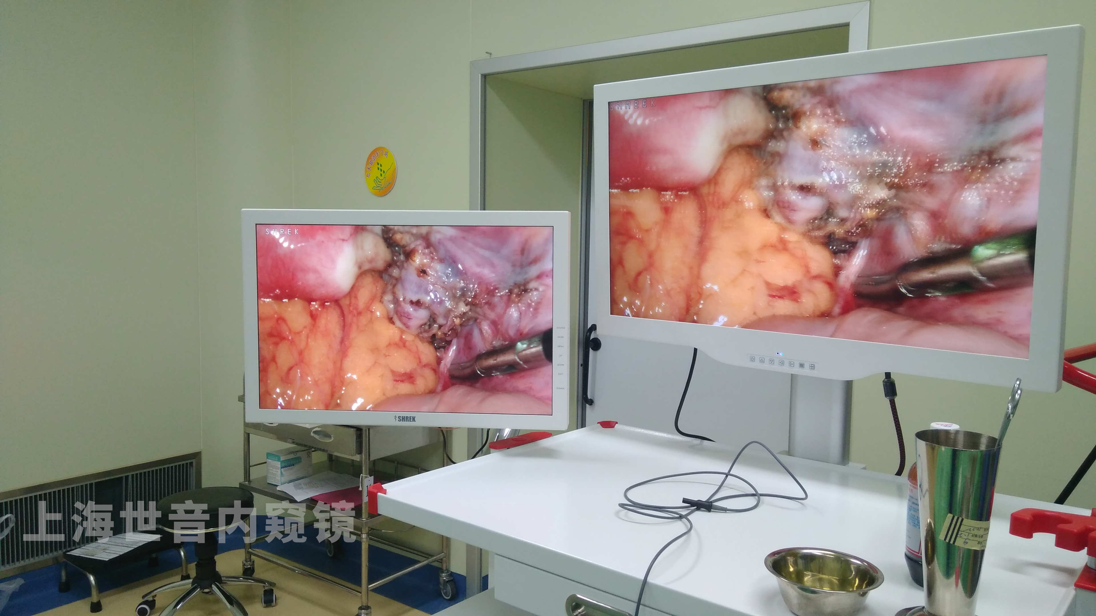 【腹腔镜篇】3D腹腔镜手术