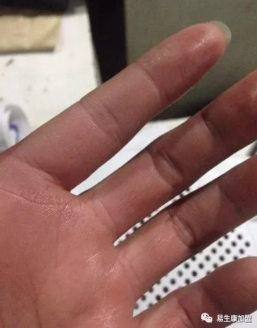 怎样解决常见的虚汗问题? 怎样解决常见的虚汗问题?