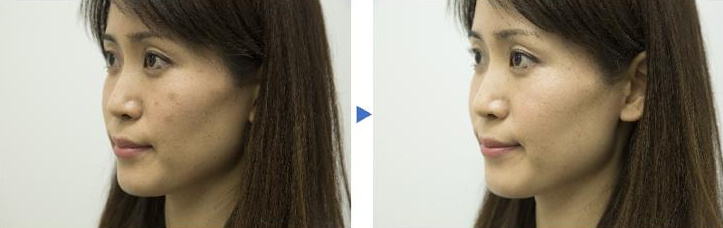 松下和Maison高丝定制雪美镜,帮助顾客定制妆容! 松下和Maison高丝定制雪美镜,帮助顾客定制妆容!