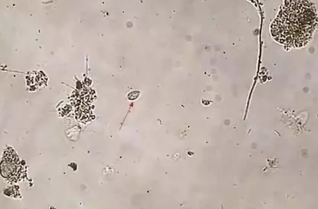 干货 | 污泥中毒的必备良方,以及污泥中毒与老化的区分方法 干货 | 污泥中毒的必备良方,以及污泥中毒与老化的区分方法
