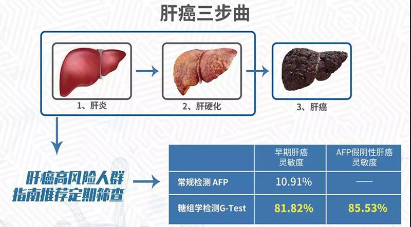 首个糖组学产品 | G-Test寡糖链肝癌早筛检测全解析