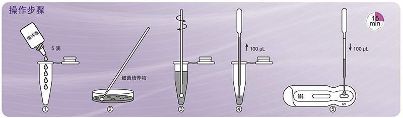 NG-Test® CARBA 5 碳青霉烯酶检测试剂盒(胶体金免疫层析法) NG-Test® CARBA 5 碳青霉烯酶检测试剂盒(胶体金免疫层析法)
