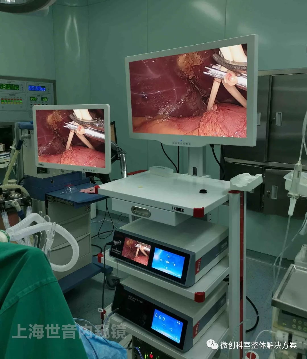【腹腔镜篇】肝切除术入路 【腹腔镜篇】肝切除术入路