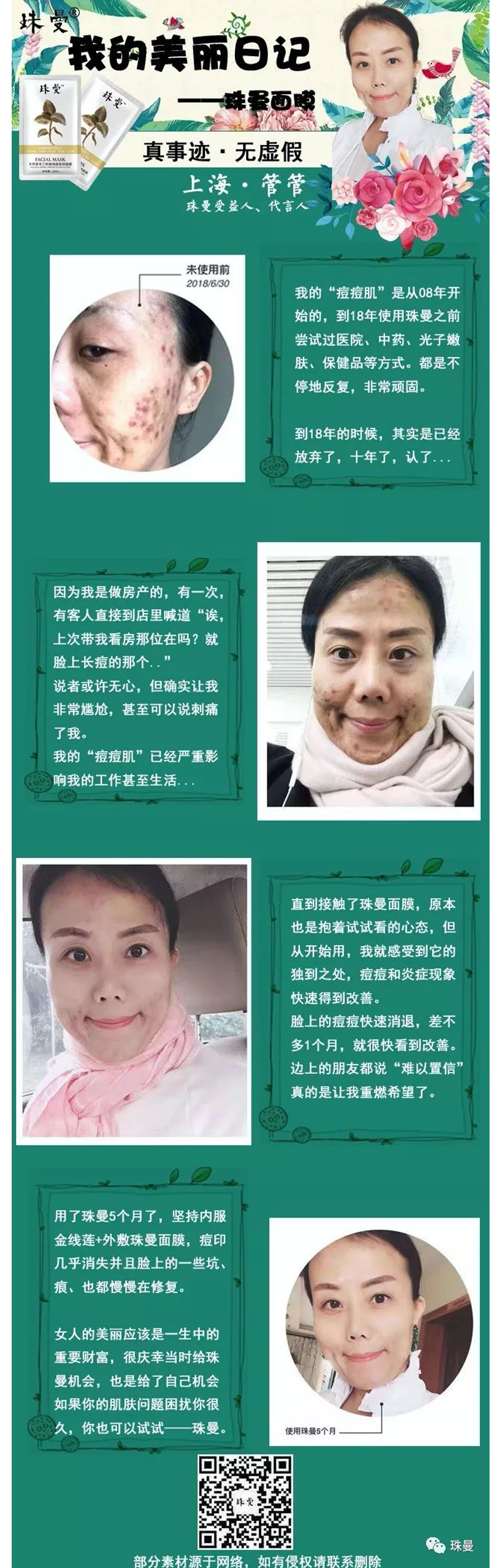 珠曼粉丝案例分享——痘痘肌 珠曼粉丝案例分享——痘痘肌