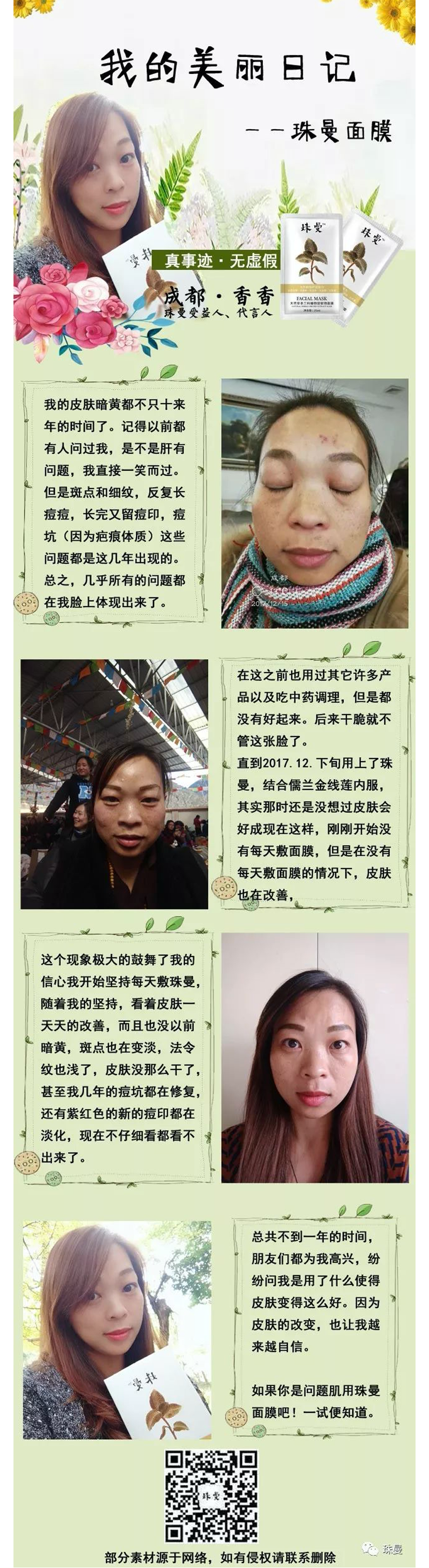 珠曼粉丝案例分享——肌肤暗黄、松弛 珠曼粉丝案例分享——肌肤暗黄、松弛