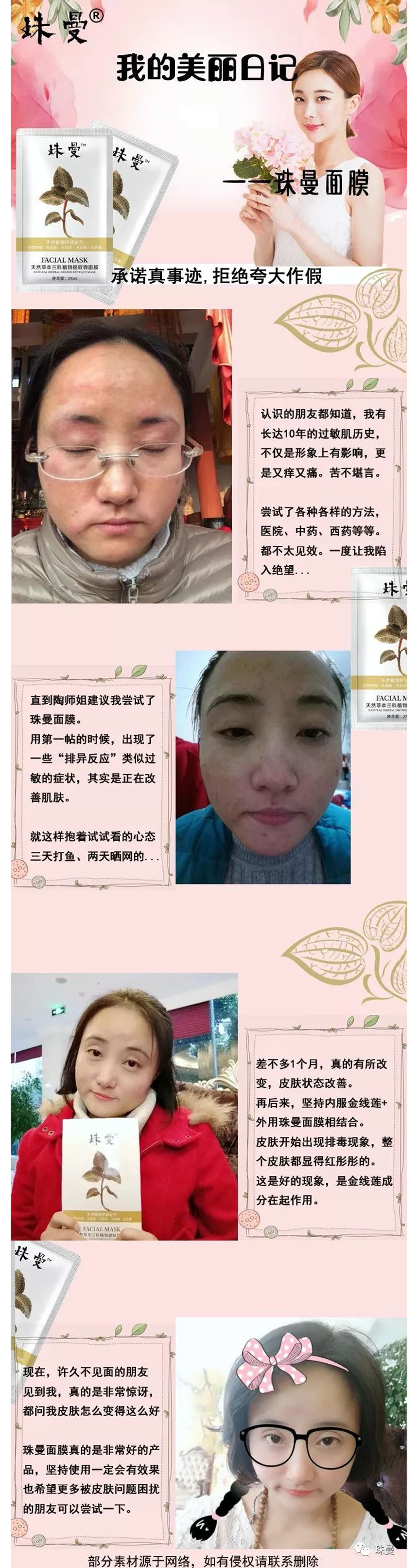珠曼粉丝案例分享——过敏肌 珠曼粉丝案例分享——过敏肌