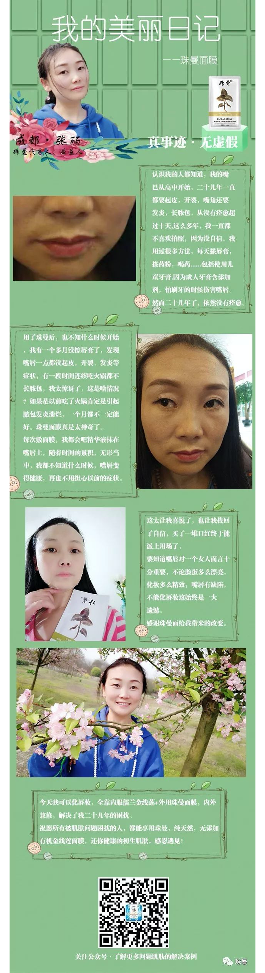 珠曼粉丝案例分享——嘴角开裂、发炎、长脓包 珠曼粉丝案例分享——嘴角开裂、发炎、长脓包