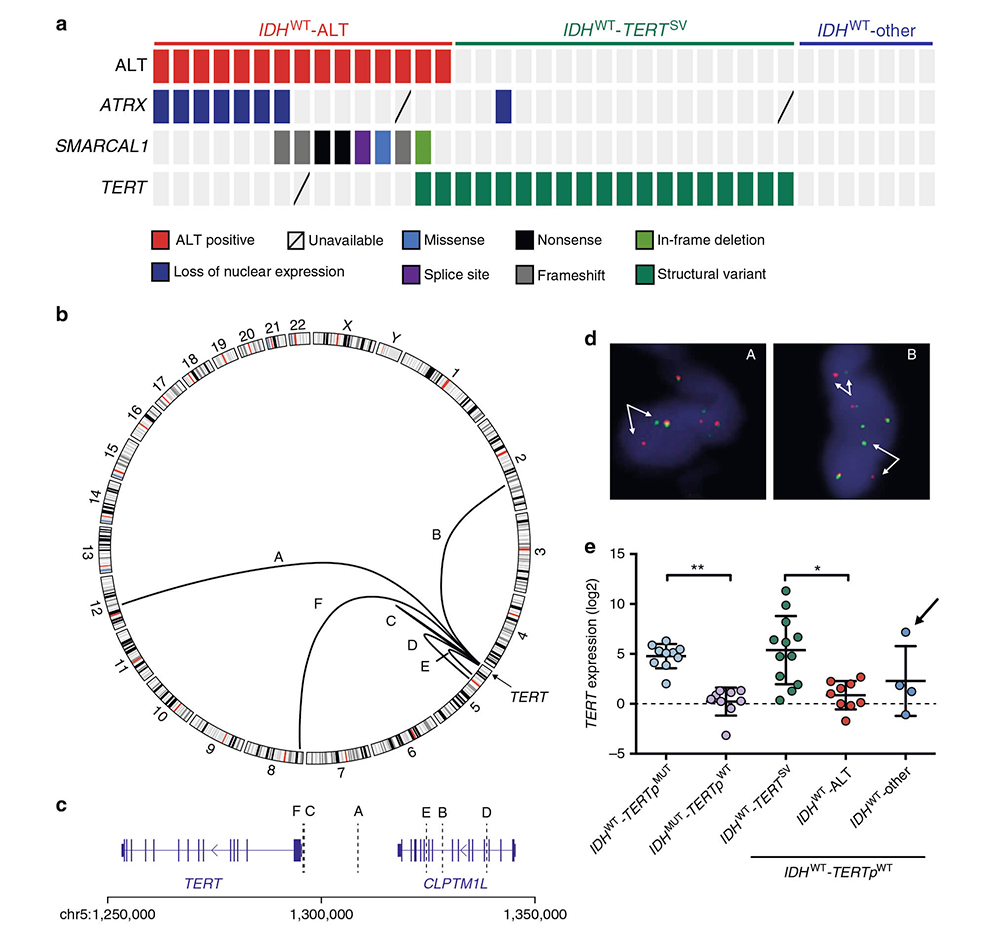 Scientists of Genetron Health Again Define Key Pathogenic Gene for Malignant Gliomas Scientists of Genetron Health Again Define Key Pathogenic Gene for Malignant Gliomas