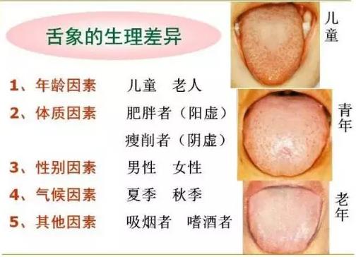 舌诊 舌诊