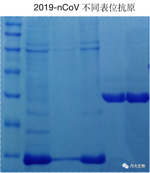 获欧盟认证！澳门新莆京游戏app新型冠状病毒IgM/IgG快速检测试剂盒最新进展