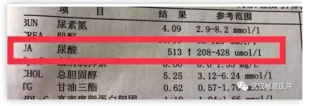 尿酸高，让全身器官受损！6步徒手解除这颗“定时炸弹”