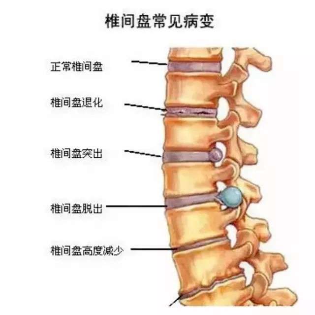 腰椎理疗私教 腰椎理疗私教