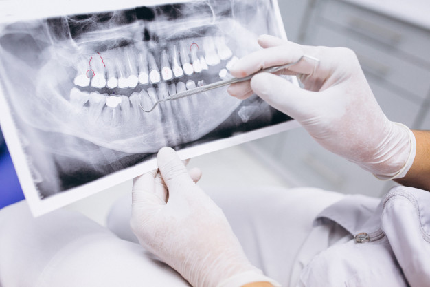 为什么有的人在深圳牙科医院做种植牙需要植骨？