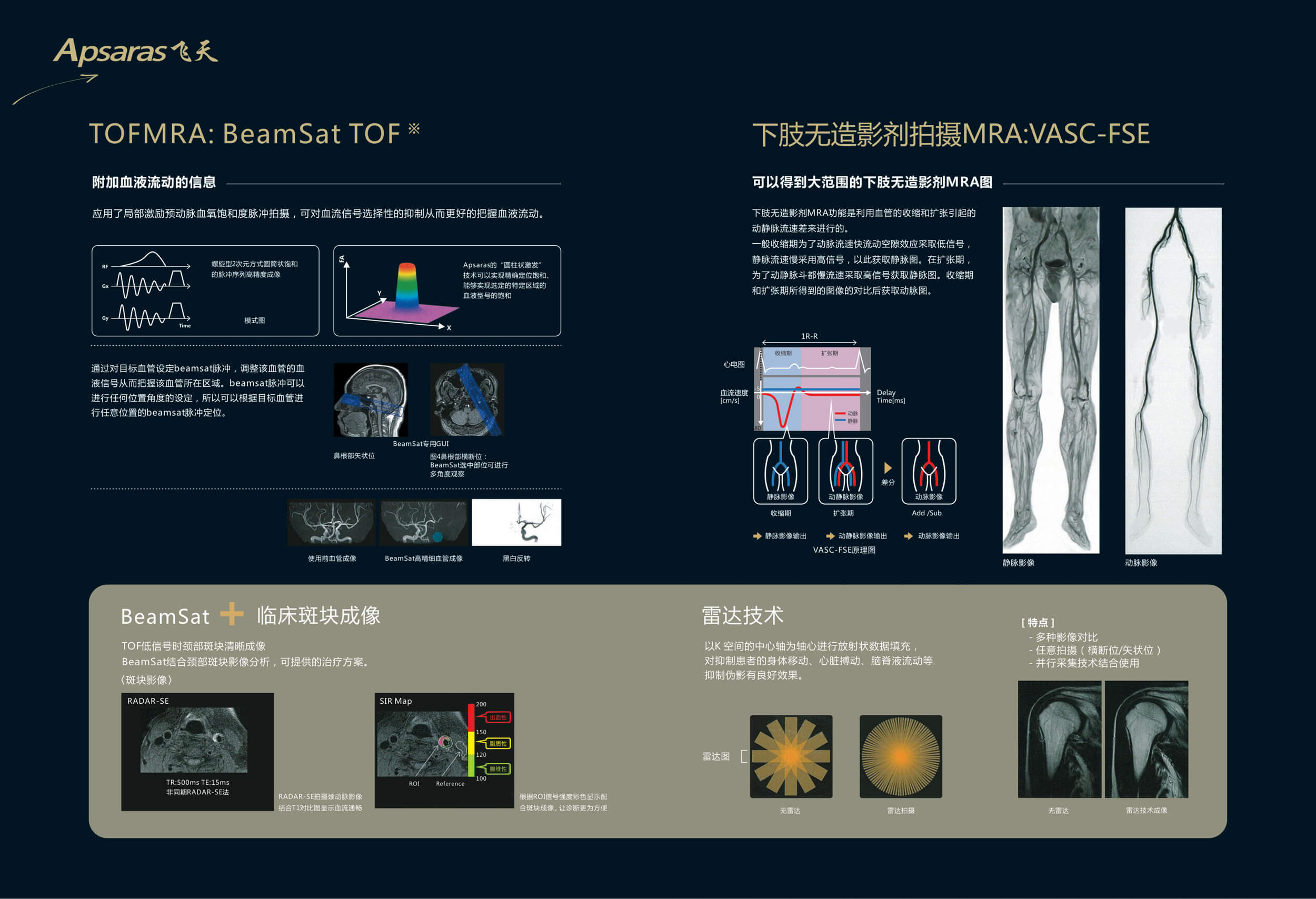 Apsaras飞天 1.5T 超导核磁共振系统