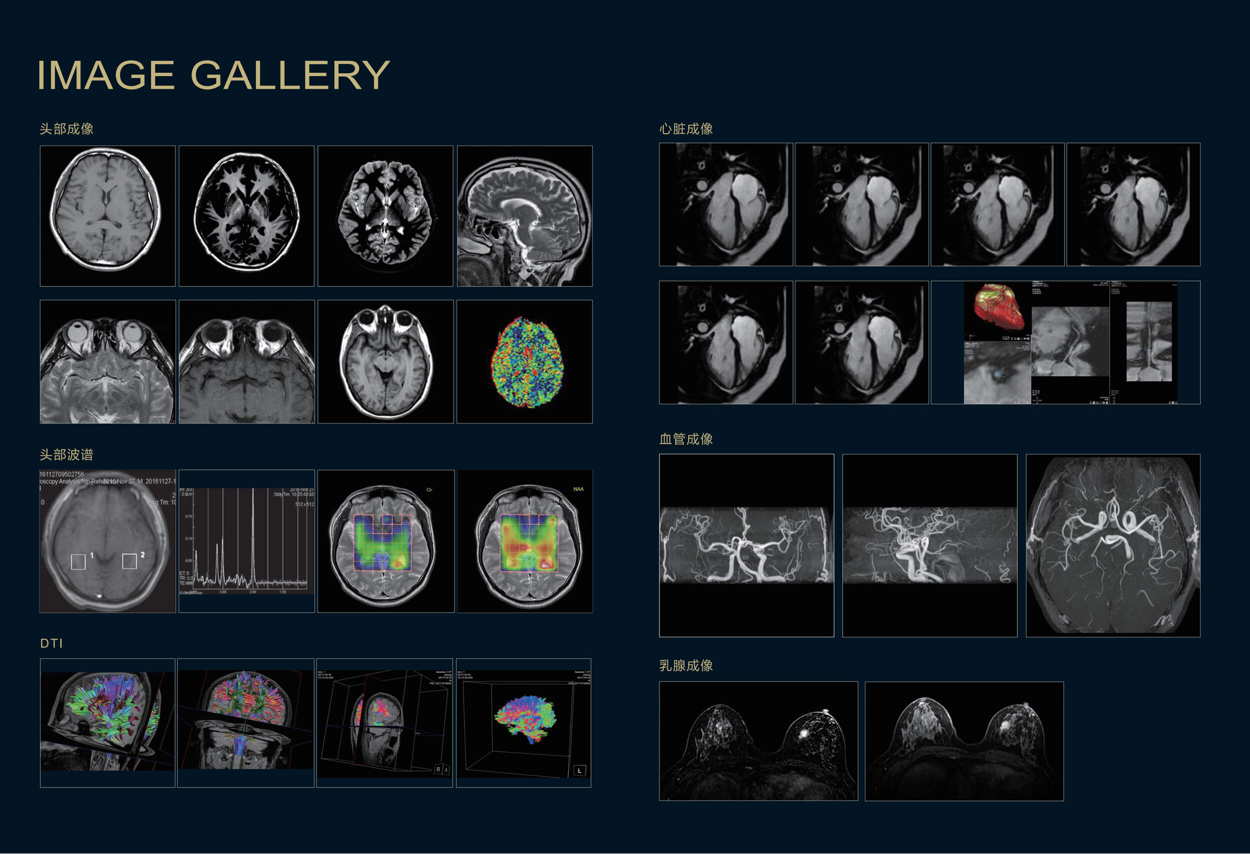 Apsaras 1.5T MRI