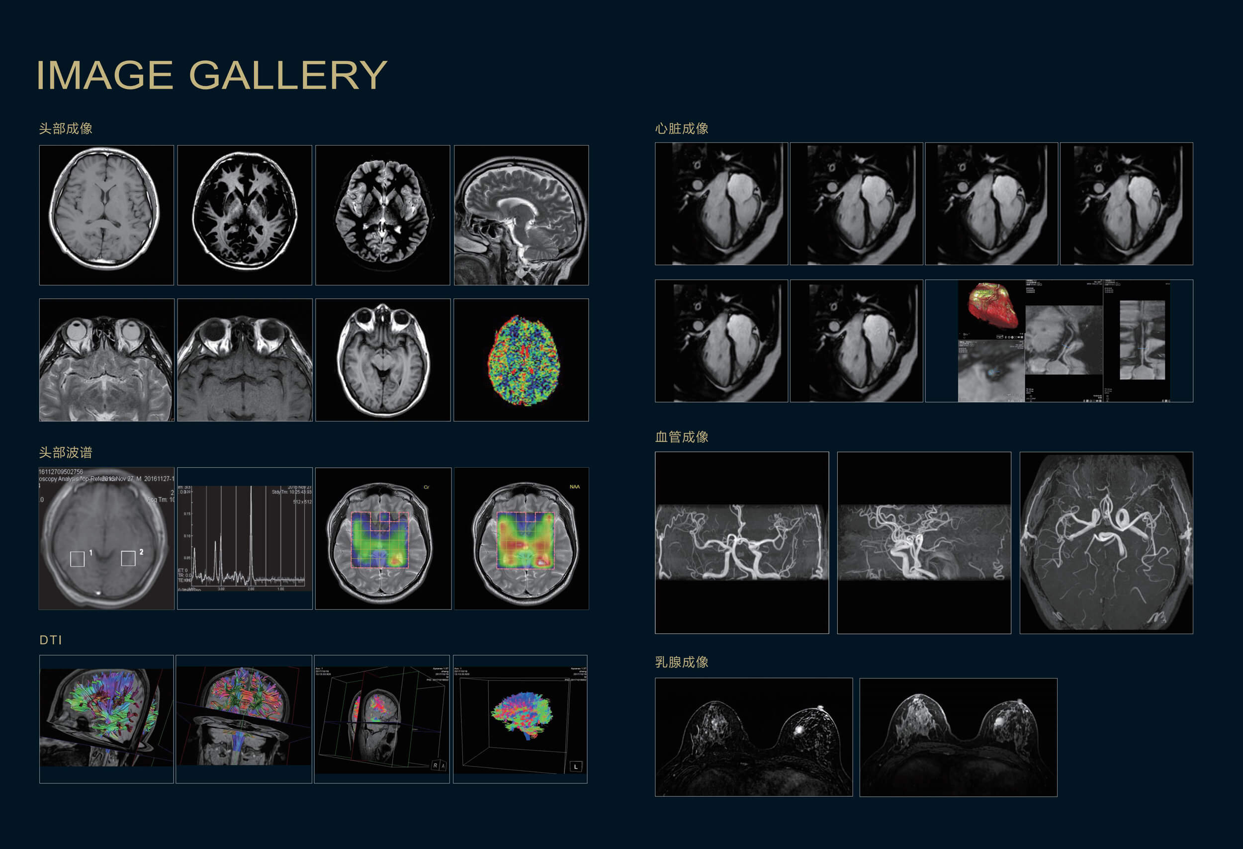 Apsaras SE 1.49T MRI