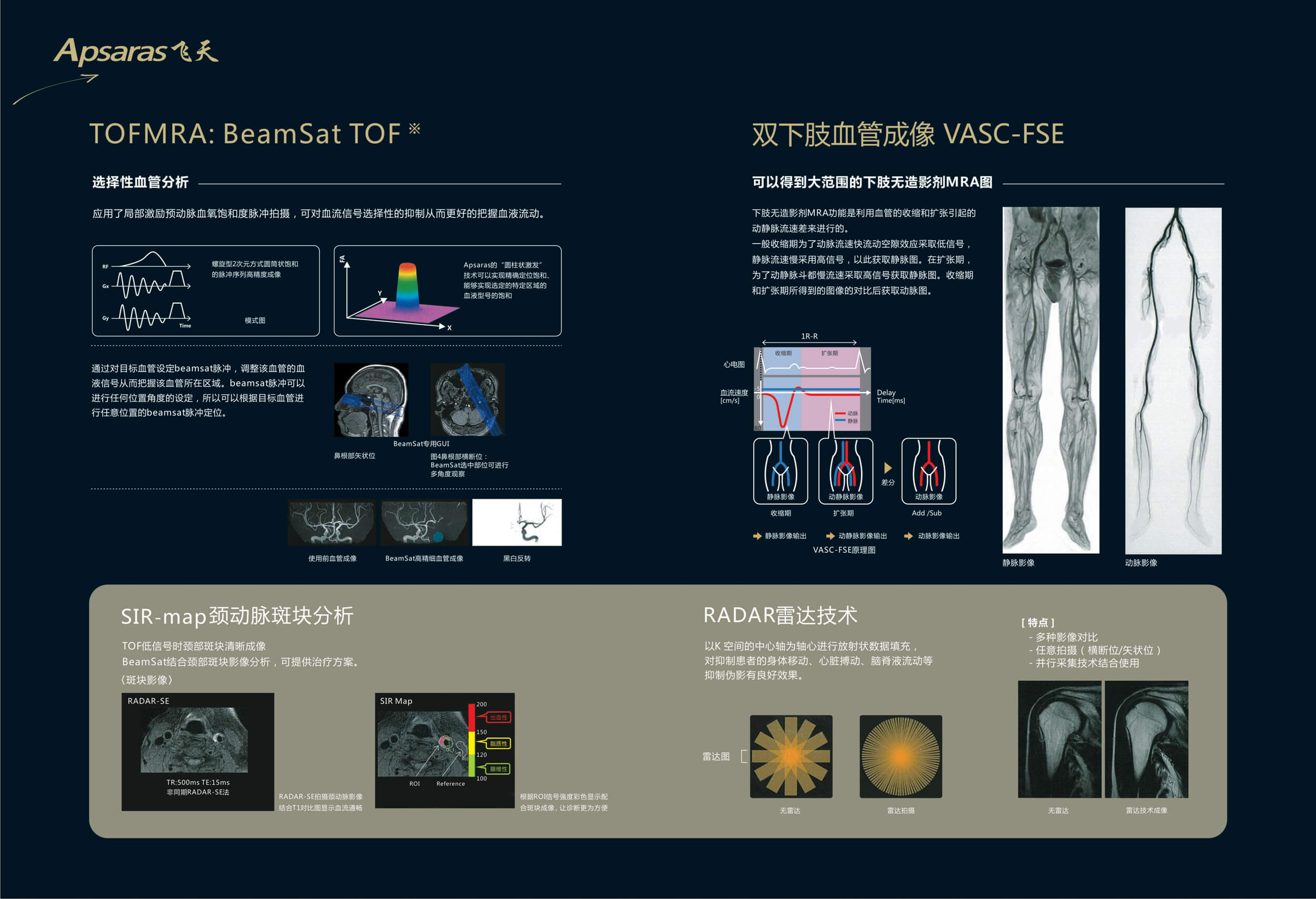 Apsaras SE 1.49T MRI