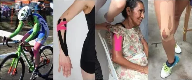 Kinesio国际认证贴扎技术初级培训班 CKTT Kinesio国际认证贴扎技术初级培训班 CKTT