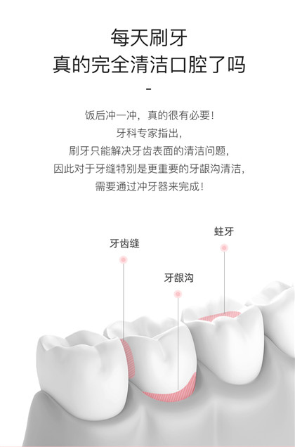 拜尔电动冲牙器_便携洗牙器