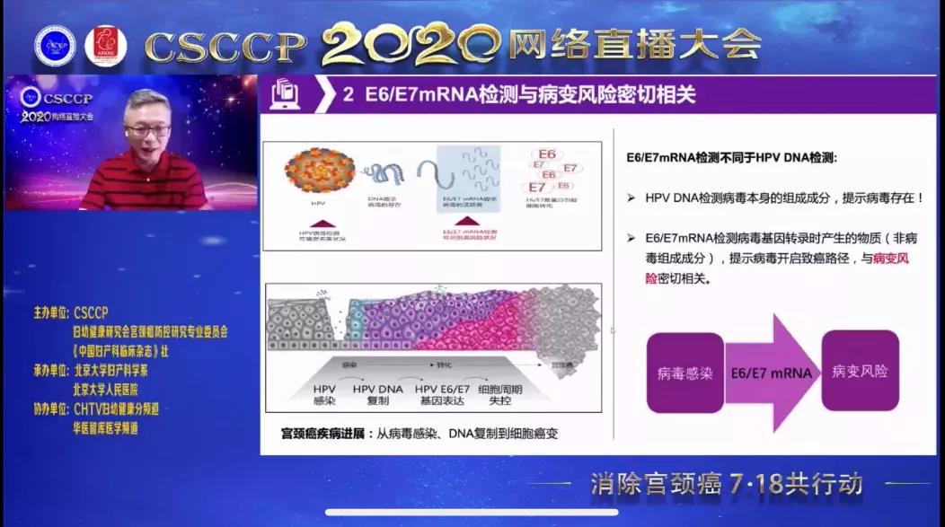 2020CSCCP会议精彩回顾 | 一种基于特异性考量的宫颈病变筛查方法