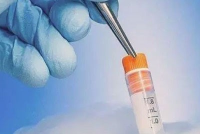 做俄罗斯试管婴儿,取卵后要注意6点 做俄罗斯试管婴儿,取卵后要注意6点