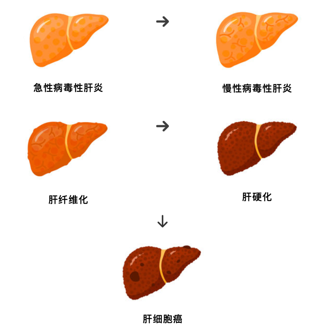 癌症会传染？坦白说：不会！但致癌病毒要警惕...