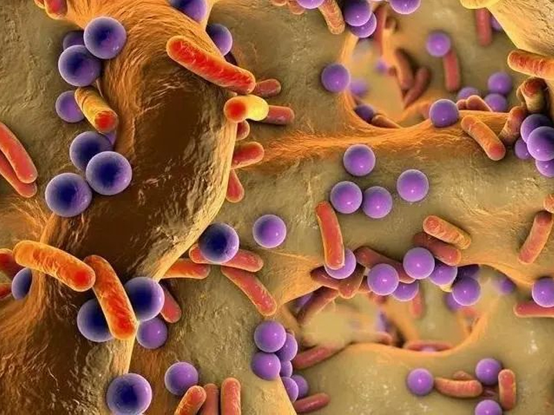 肥胖的關鍵是腸道菌群的變化 | 代謝組學技術揭示分析研究 肥胖的關鍵是腸道菌群的變化 | 代謝組學技術揭示分析研究