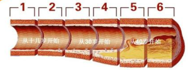红杉健康小课堂(第2期)——血脂是什么? 红杉健康小课堂(第2期)——血脂是什么?