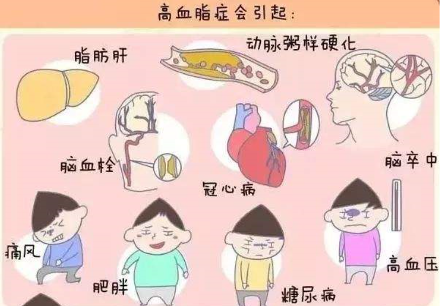 红杉健康小课堂(第2期)——血脂是什么? 红杉健康小课堂(第2期)——血脂是什么?