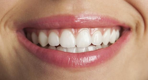 在深圳牙齿矫正后能对齐牙齿中线吗