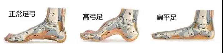 关爱孩子的足部健康|给孩子做一次全面的步态检测吧! 关爱孩子的足部健康|给孩子做一次全面的步态检测吧!