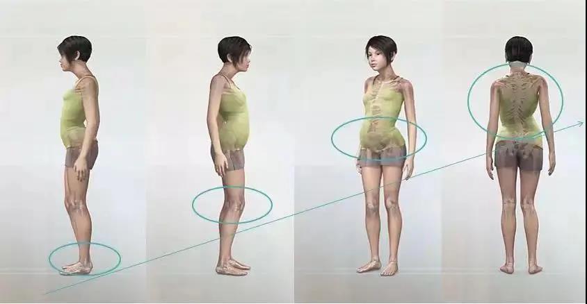 关爱孩子的足部健康|给孩子做一次全面的步态检测吧! 关爱孩子的足部健康|给孩子做一次全面的步态检测吧!