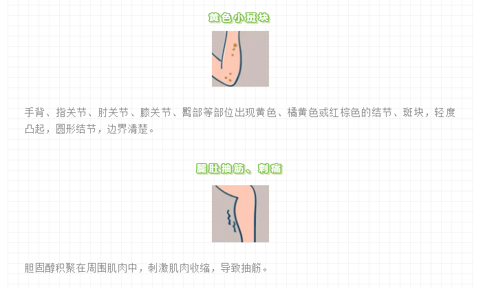 一文读懂「血脂异常」：超4亿国人的血脂悄悄越界了