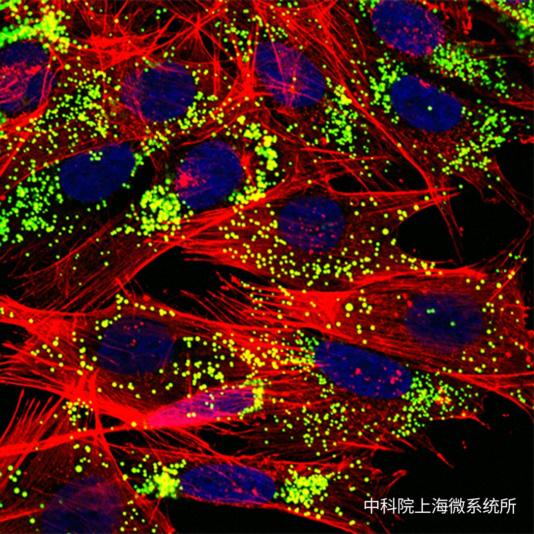 上海微系统所在肿瘤早期可视化预警方面取得重要进展