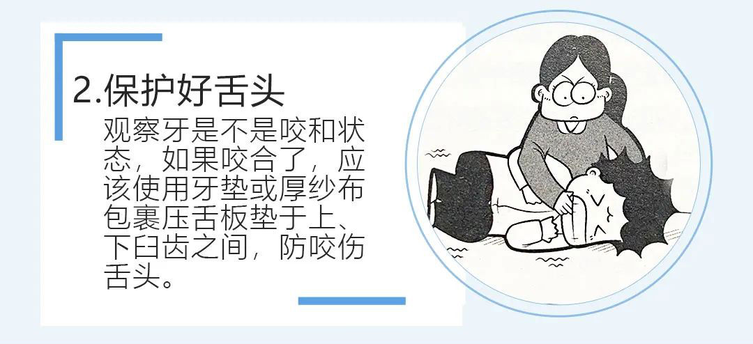 癫痫发作的高发季，如何正确处理！
