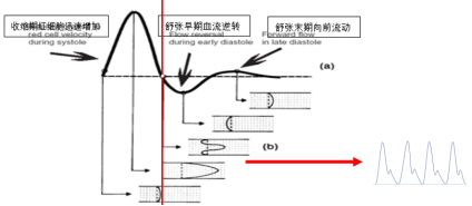 如何判断血液流速变化与健康的相关性？